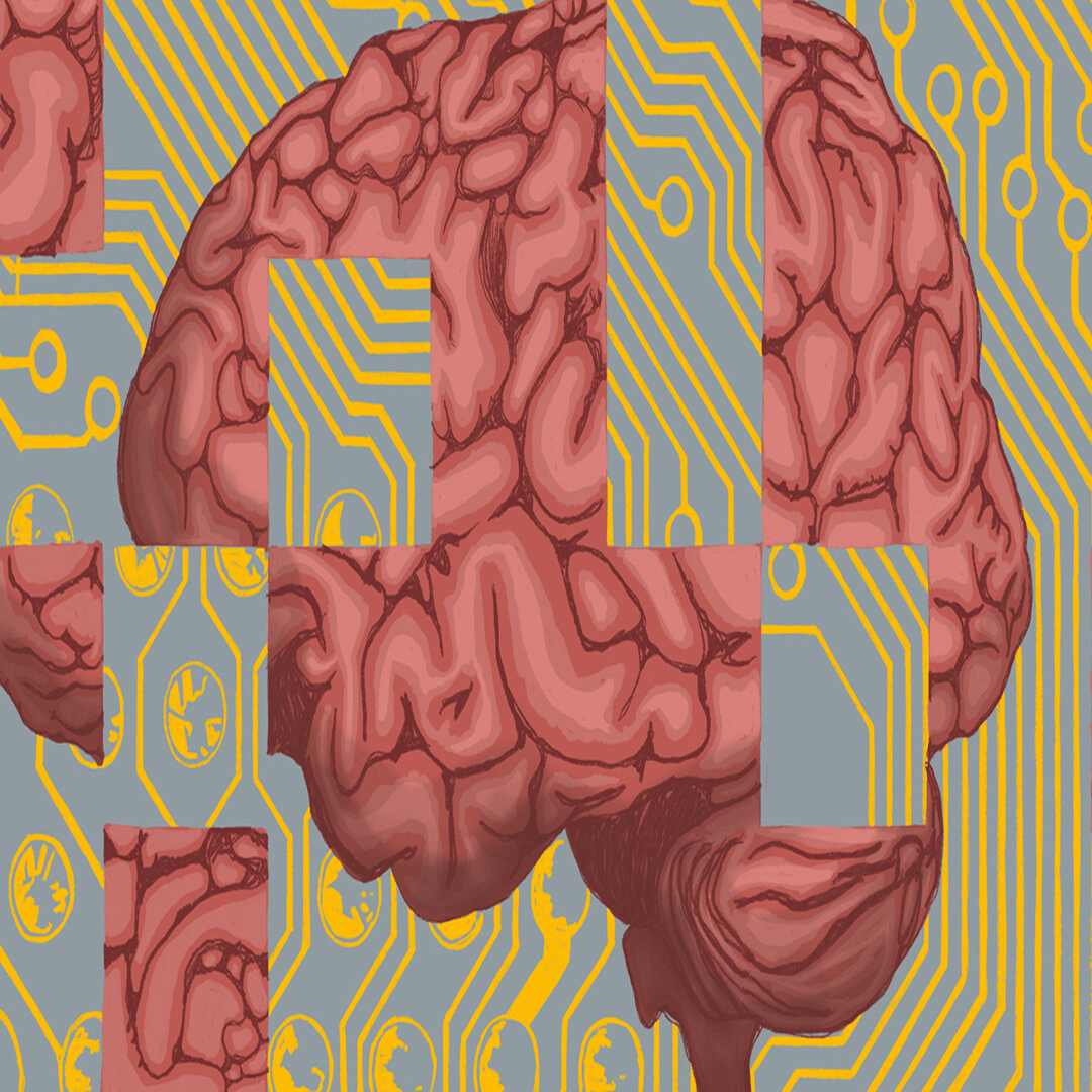Brain Alzheimer Detection